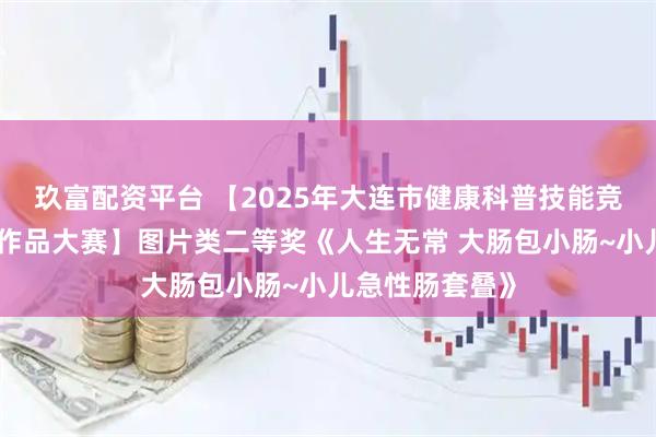 玖富配资平台 【2025年大连市健康科普技能竞赛暨健康科普作品大赛】图片类二等奖《人生无常 大肠包小肠~小儿急性肠套叠》